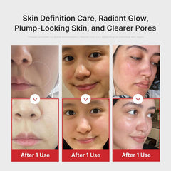 [ Medicube ] Age-R Booster Pro Pink | 6-in-1 Real Glass Glow Beauty Massager