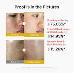 [ MEDICUBE ] Kojic Acid Turmeric Peel Shot 80ml /2.7 oz.