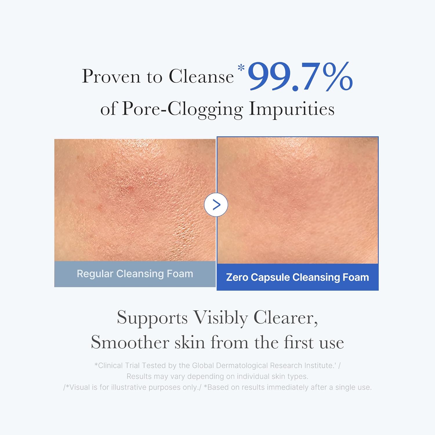 [ MEDICUBE ] ZERO PORE SA CLEAR CAPSULE CLEANSING FOAM 120g / 4.23 oz