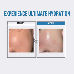 [ JUMISO ] Waterfull Hyaluronic Serum 50ml / 1.69 fl.oz