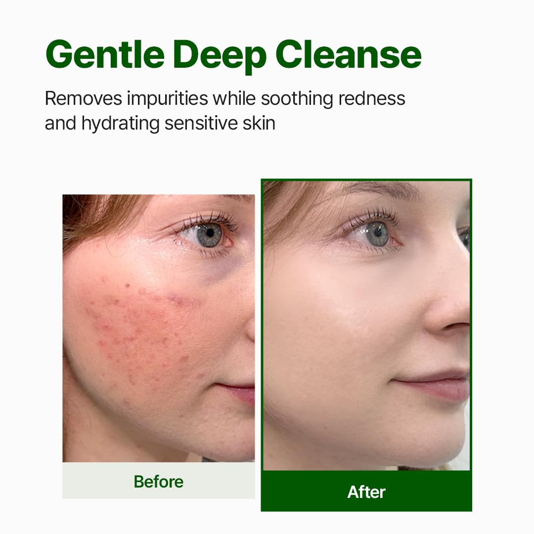 [ NACIFIC ] CICA + PDRN Gel Cleanser +Synergy Blend 200ml / 6.76 fl.oz - KosBeauty