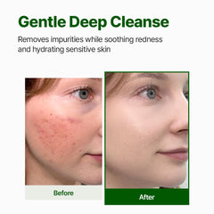 [ NACIFIC ] CICA + PDRN Gel Cleanser +Synergy Blend 200ml / 6.76 fl.oz - KosBeauty