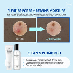 [ JUMISO ] Pore Purifying Salicylic Acid Foaming Cleanser 120g / 4.23 oz