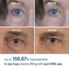 [ Dr.Melaxin ] Eyephalt Eyebag Cream 10g / 0.35oz