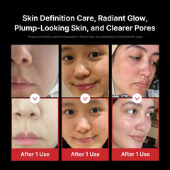 [ Medicube ] Age-R Booster Pro Black + Collagen Jelly Cream 50ml - KosBeauty