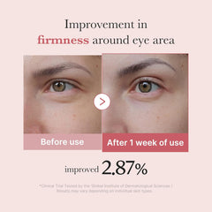 [ MEDICUBE ] PDRN Pink Peptide Eye Cream 30ml / 1.01 fl.oz