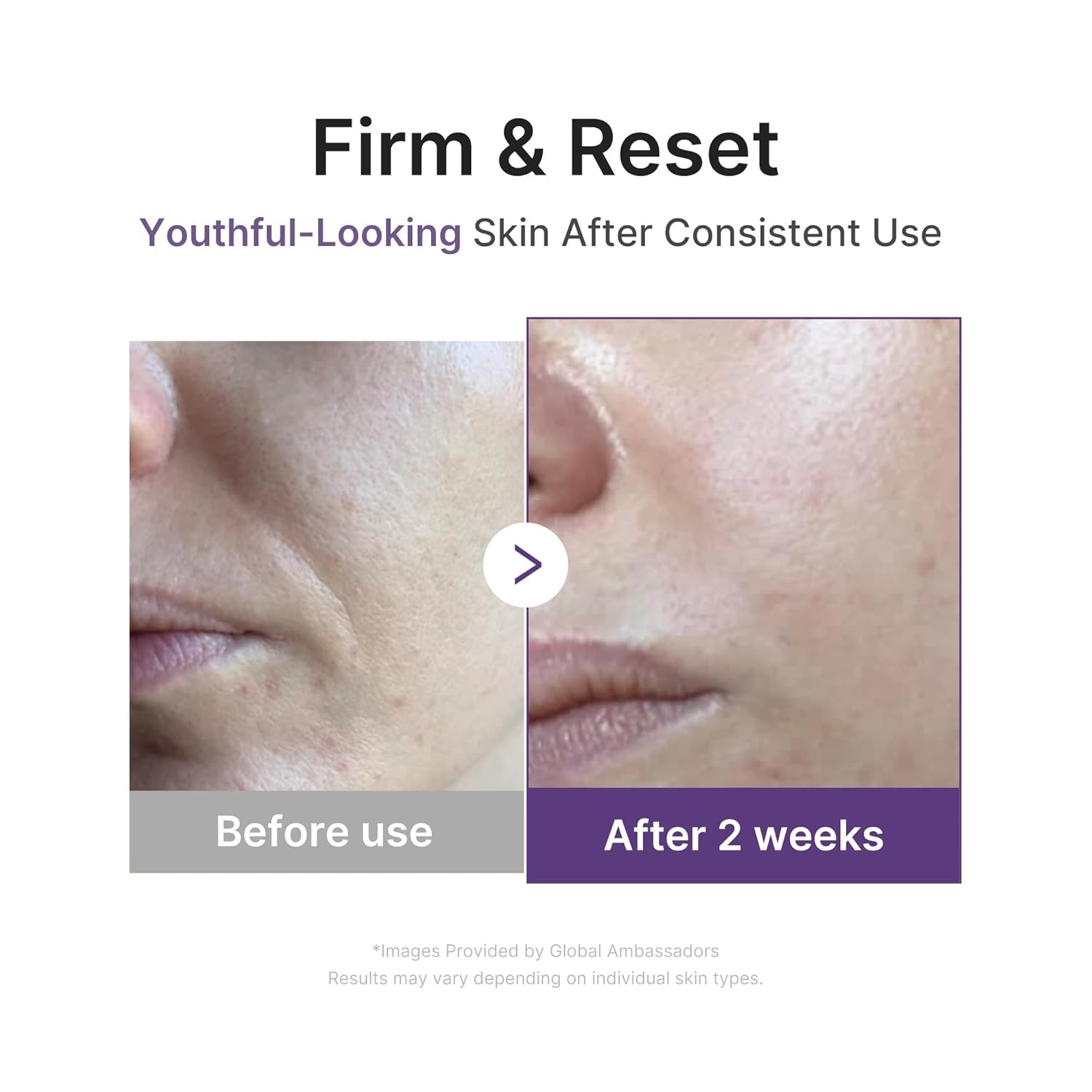 [ MEDICUBE ] Retinol NMN Boosting Serum  30ml / 1.01 fl.oz. - KosBeauty