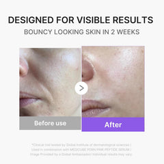 [ Medicube ] Age-R Booster Pro Mini Plus Pink - KosBeauty