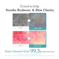 [ MEDICUBE ] Azelaic Acid Niacinamide Deep Clean Foam Cleanser 120g / 4.23 oz