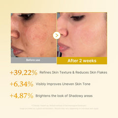 [ MEDICUBE ] Kojic Acid Turmeric Smoothing Toner 250ml / 8.45 fl.oz