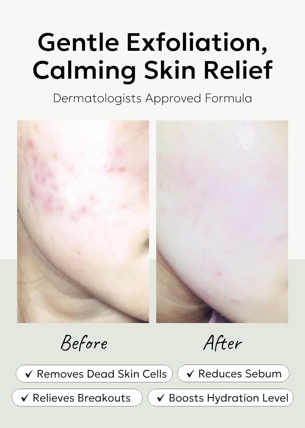 Celimax JI WOO GAE Heartleaf BHA Peeling Pad, 125ml / 4.22 fl.oz / 60 pads