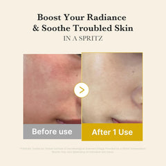 [ MEDICUBE ] Kojic Acid Turmeric Vita Jelly Mist Serum 100ml / 3.38 fl.oz. - KosBeauty