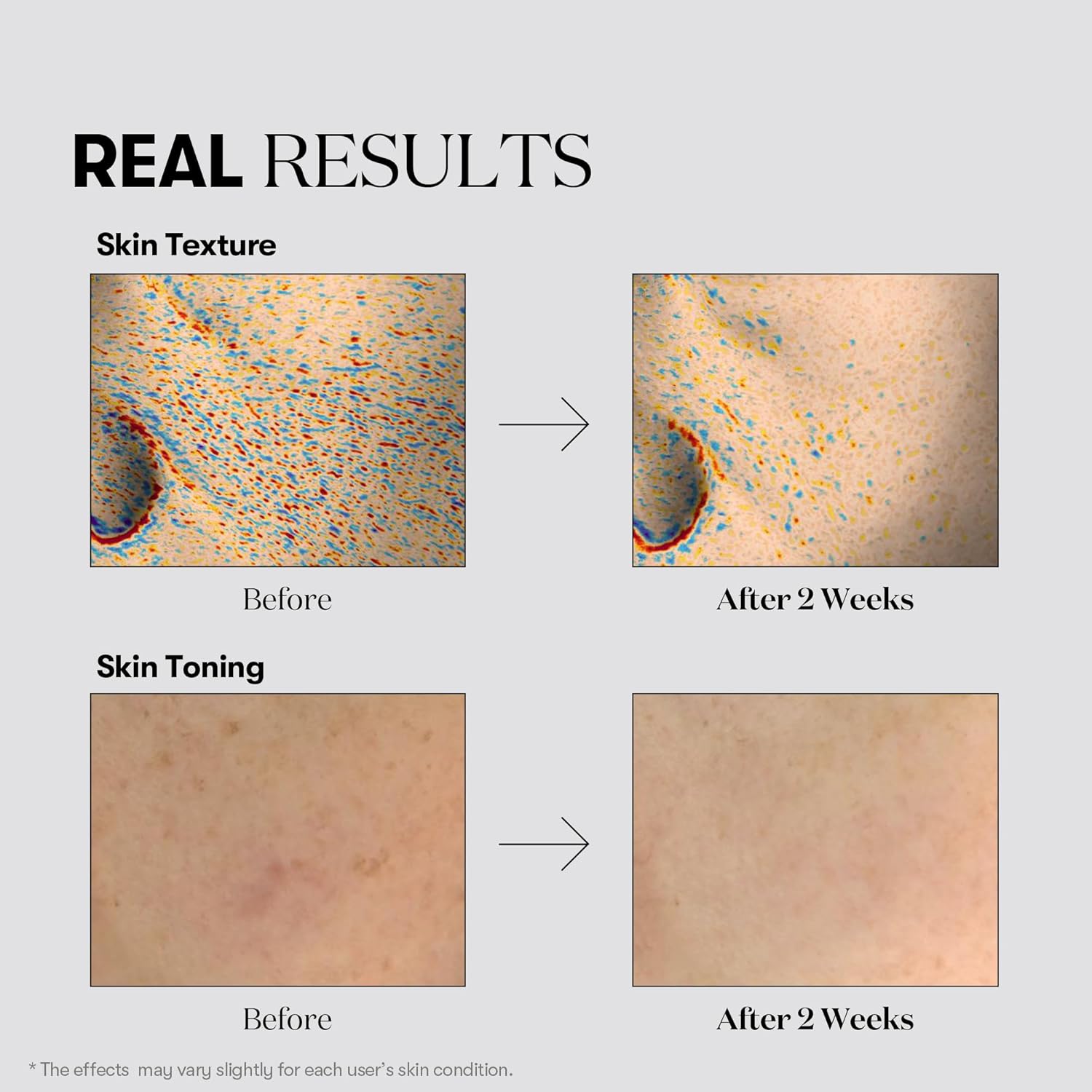[ VT COSMETICS ] TX-Toning Daily Mask 30ea