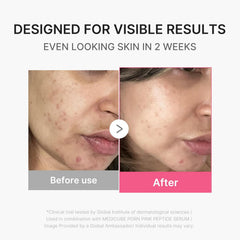 [ Medicube ] Age-R Booster Pro Mini Plus Beige