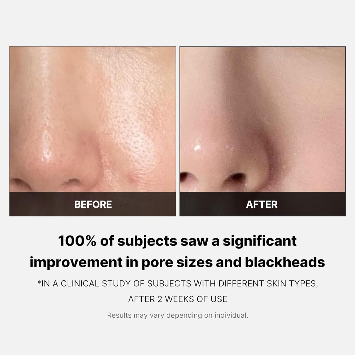 [ MEDICUBE ] ZERO PORE PAD 2.0 155g, 5.46oz (70 pads)