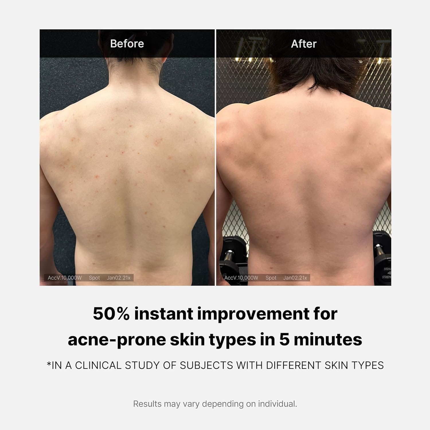 [ MEDICUBE ] Red Acne Body Wash 400g / 14.10 oz.