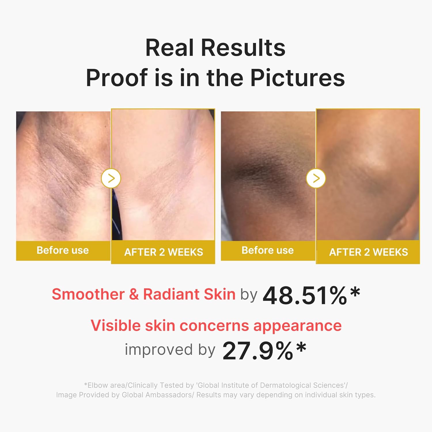 [ MEDICUBE ] Kojic Acid Turmeric Body Peel Shot 280ml /9.46 oz. - KosBeauty