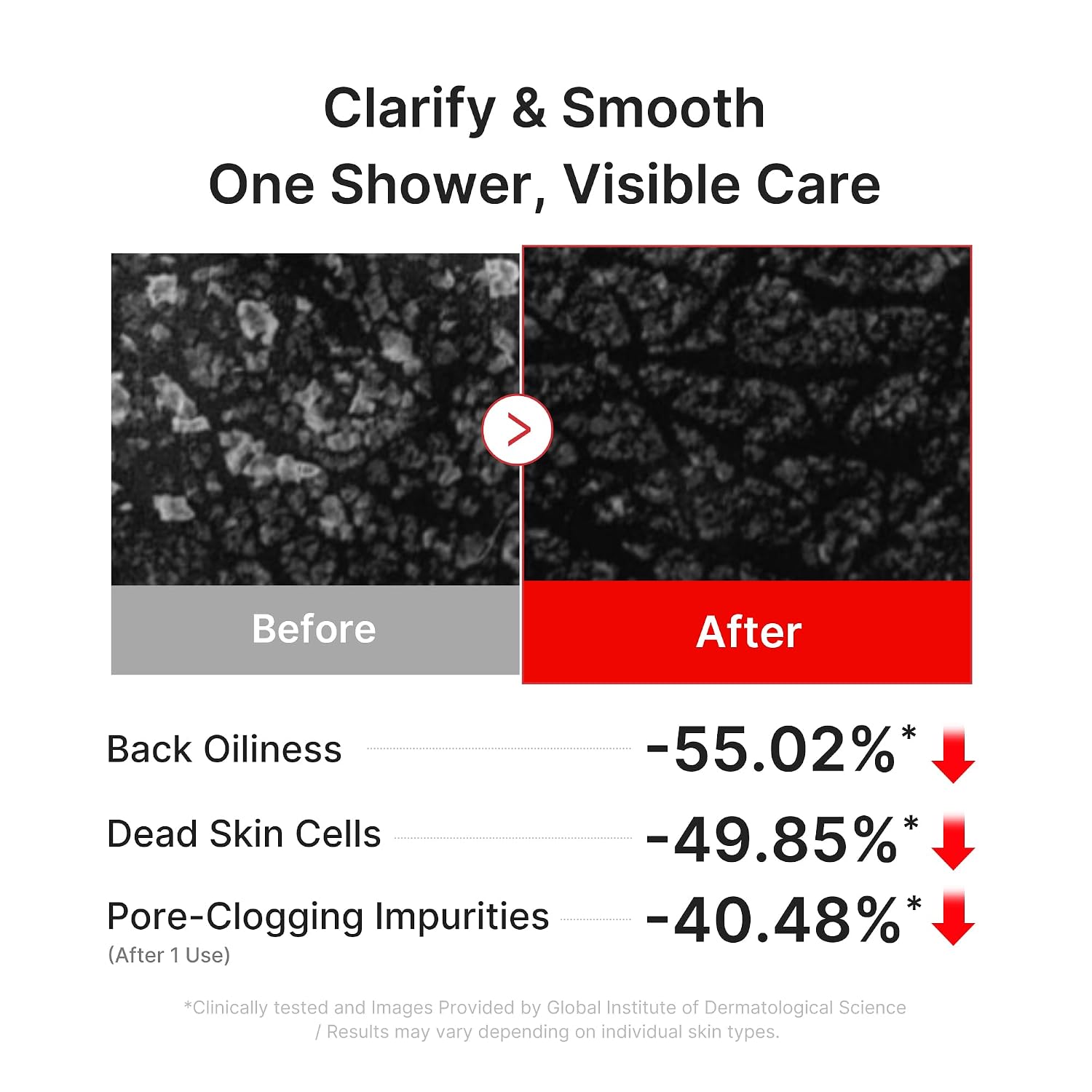[ MEDICUBE ] Red Acne Body Wash 3.0 400ml / 13.52 fl.oz. - KosBeauty