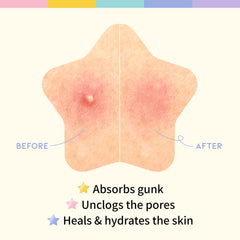 [ OOTD ] Star Spot Acne/Pimple Patch for Face 12mm X 80Pcs (16pcs x 5ea)