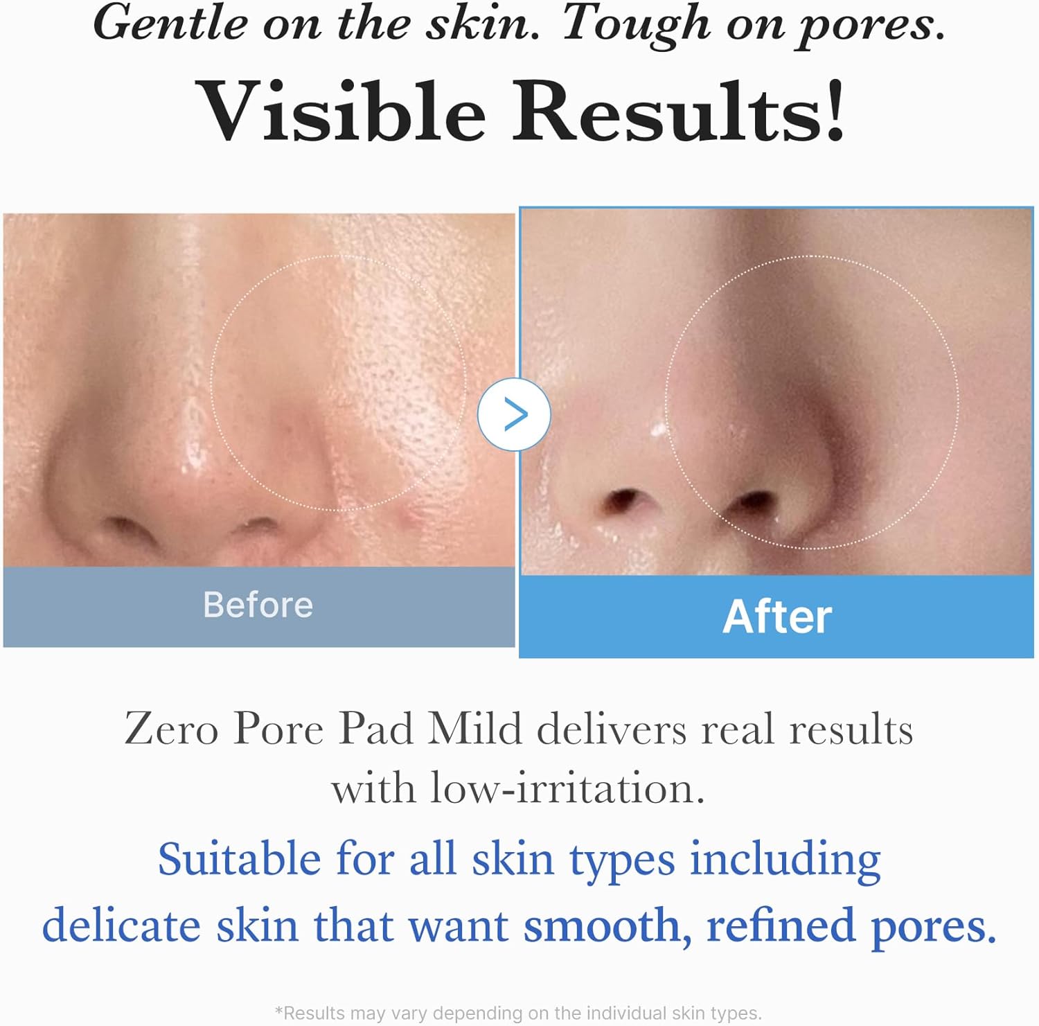 [ MEDICUBE ] ZERO PORE PAD MILD 155g /5.46oz (70 pads)