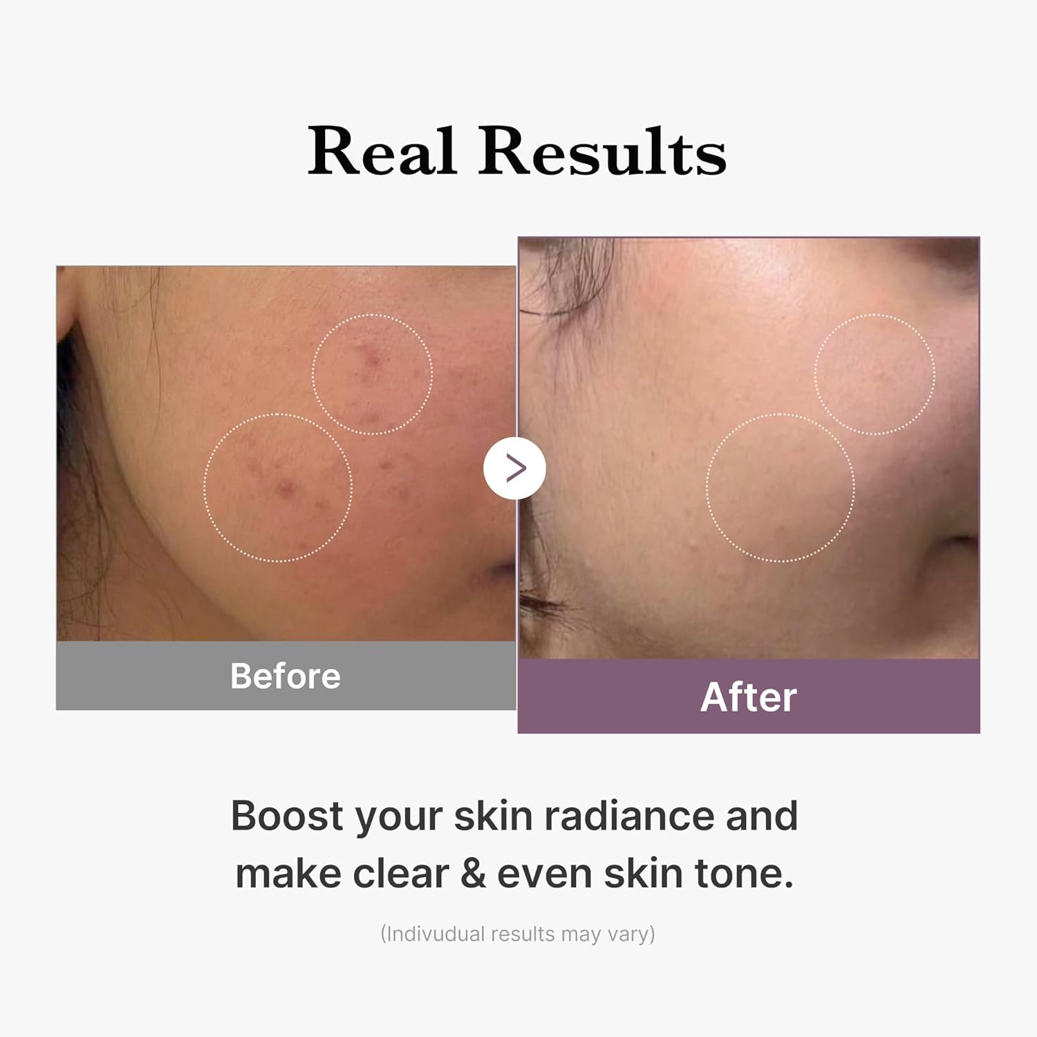 [ MEDICUBE ] AGE-R Glutathione Glow Toner 140ml / 4.73 fl.oz - KosBeauty