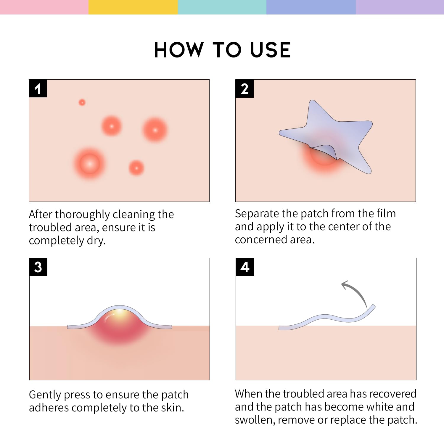 [ OOTD ] Star Spot Acne/Pimple Patch for Face 12mm X 80Pcs (16pcs x 5ea)