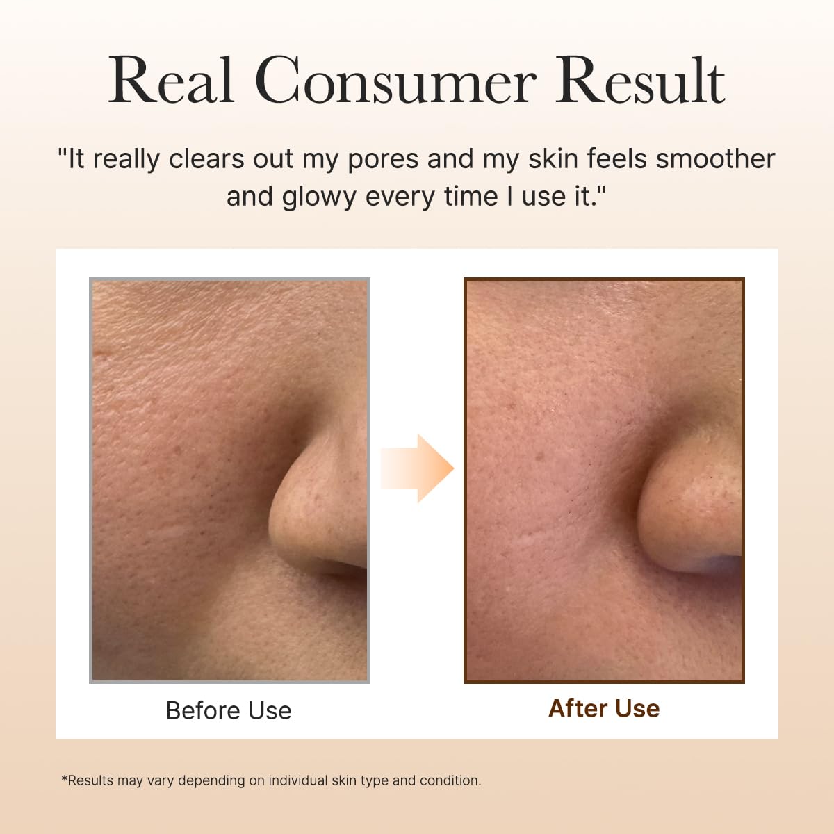 [ Arencia ] Calendula Rice Mochi Fresh Cleanser 120g / 4.23oz