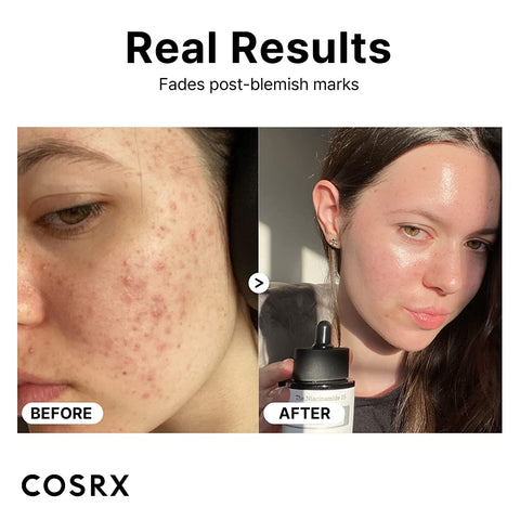 [ COSRX ] The Niacinamide 15 Serum (20ml / 0.67 fl. oz)