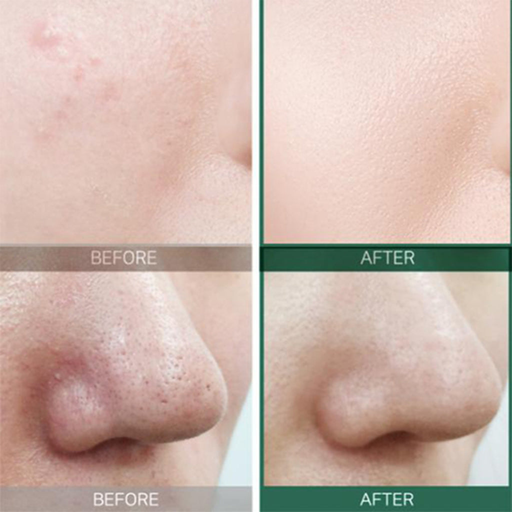 [ SOME BY MI ] AHA-BHA-PHA 30 days Miracle Toner 150ml