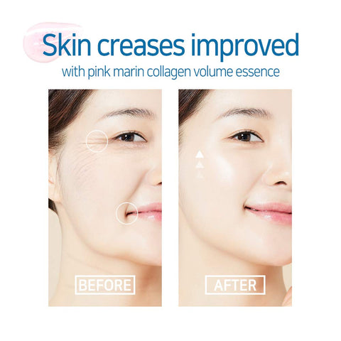 Elizavecca Witch Piggy Hell Pore Marine Collagen Ample 50ml