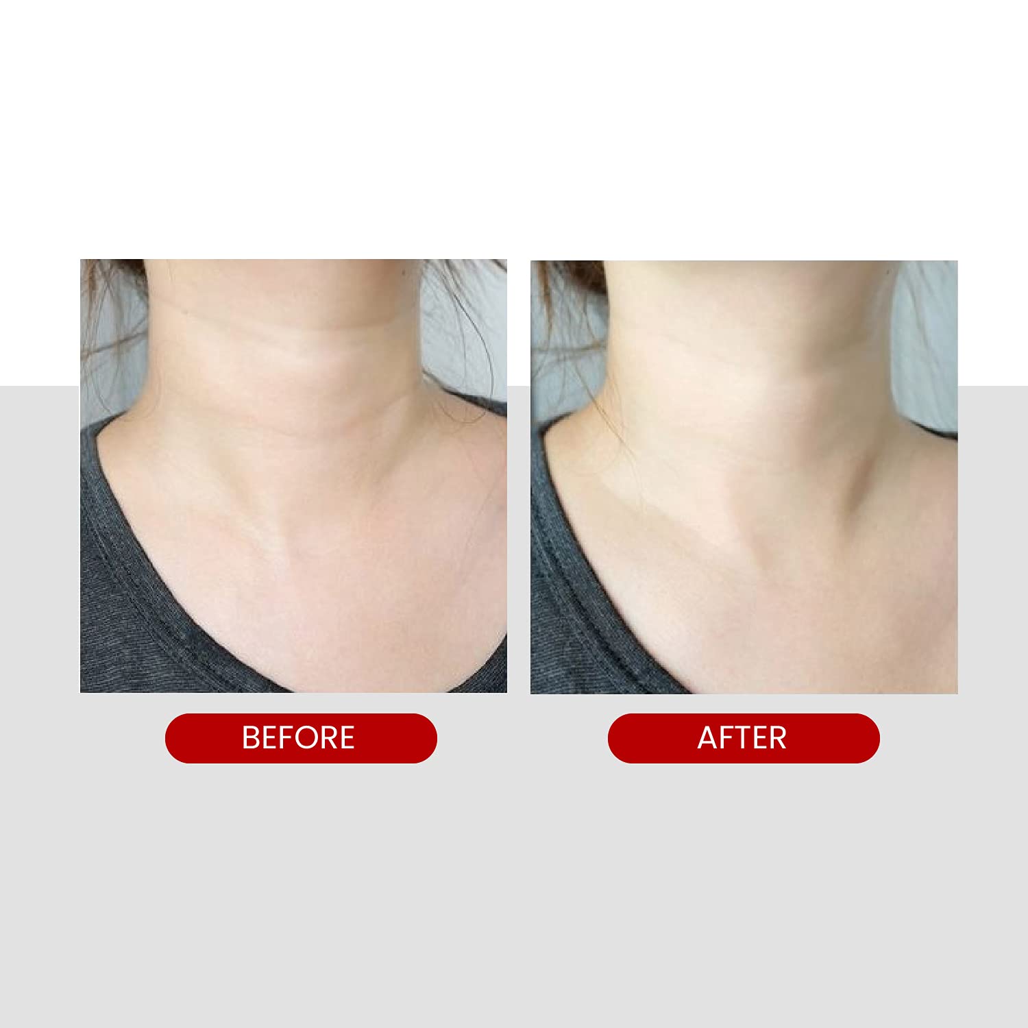 Medi-Peel Premium Naite Thread Neck Cream for Firming and Anti-aging 100ml / 3.38 fl. oz.