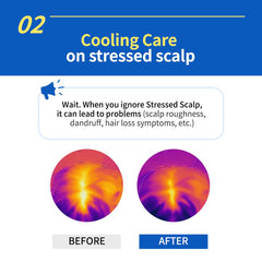 Ryo Hair Loss Expert Care Shampoo for Anti-Dandruff, 400ml ( EXP : 09/13/2025)