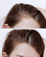 [ RYO ] Anti Hair Loss Expert Care Shampoo For Normal & Dry Scalp, 400ml